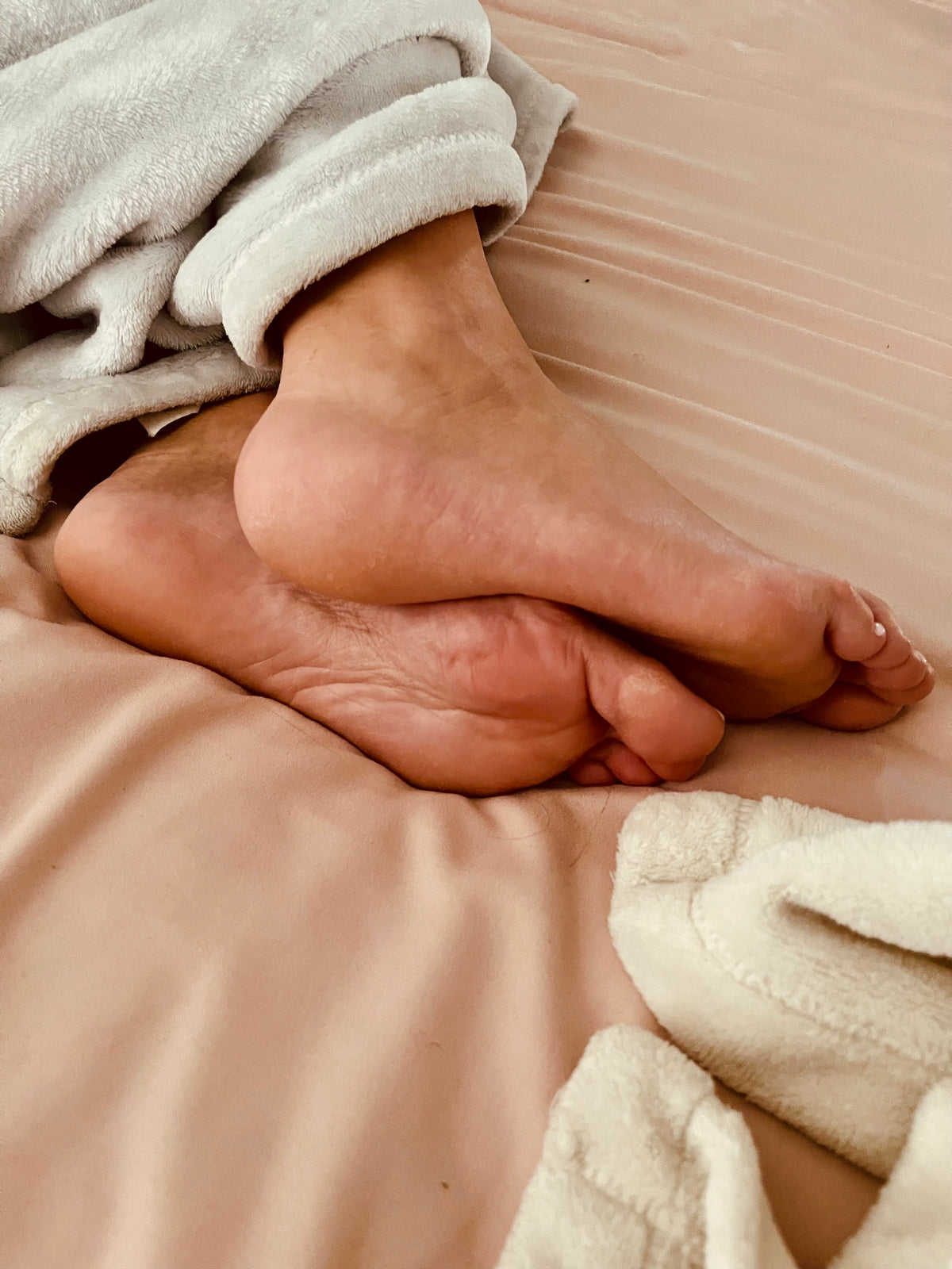 Bunions