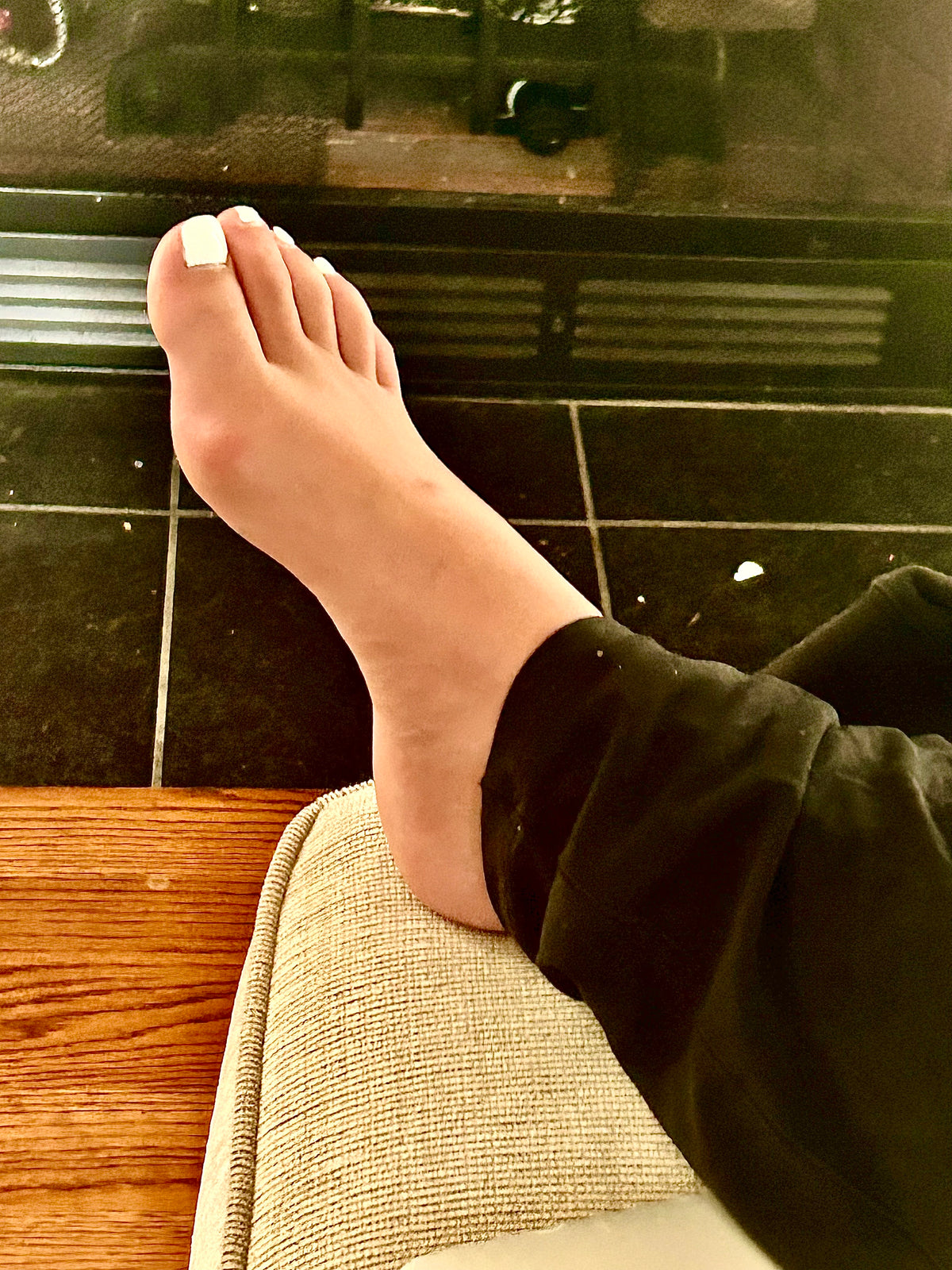 Bunions