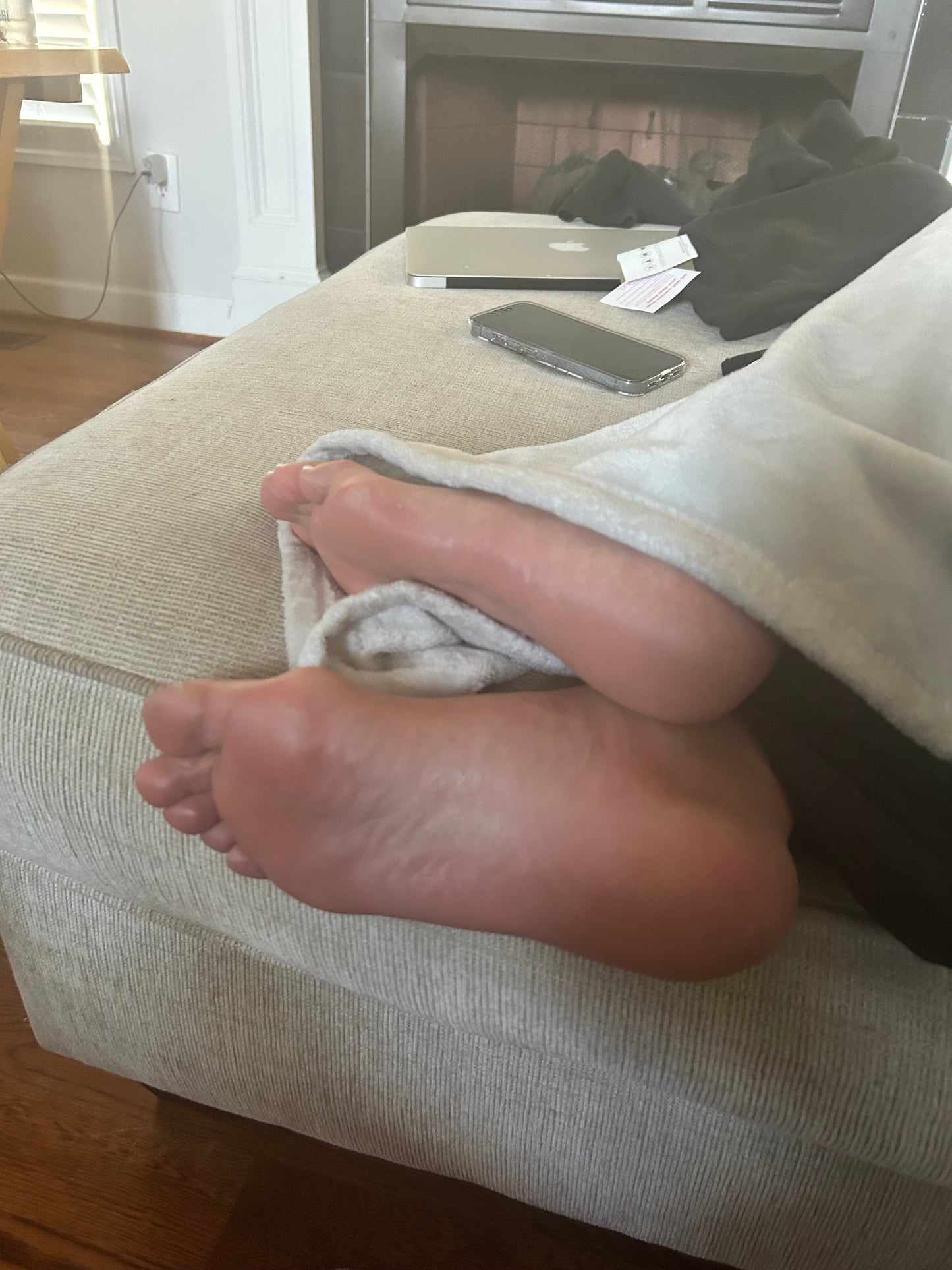 Bunions