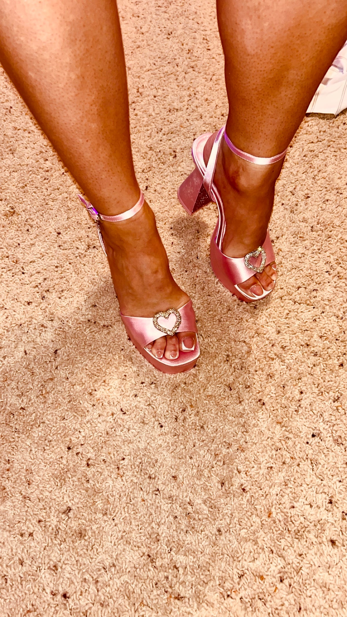 Bunions