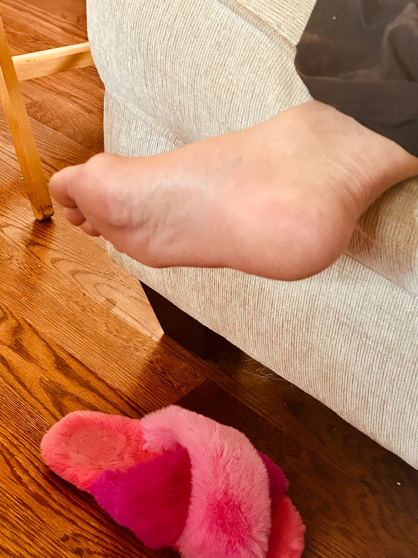 Bunions